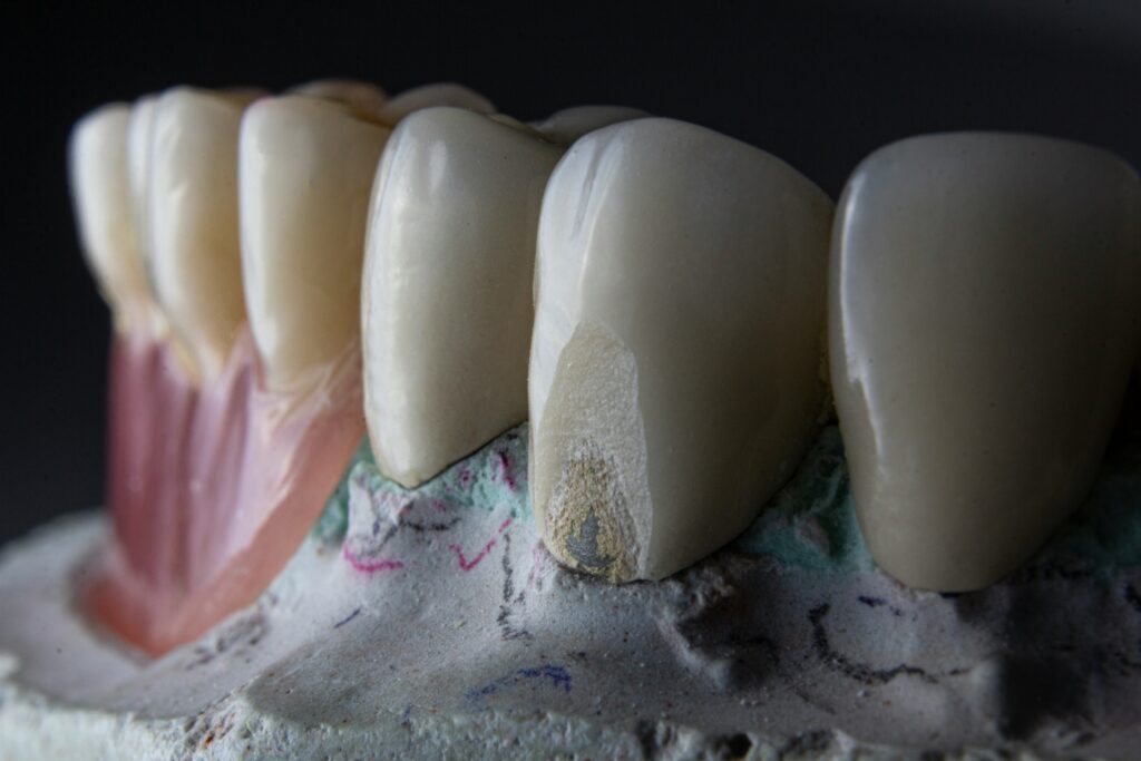 gum issue a dentist in Lagos sees
