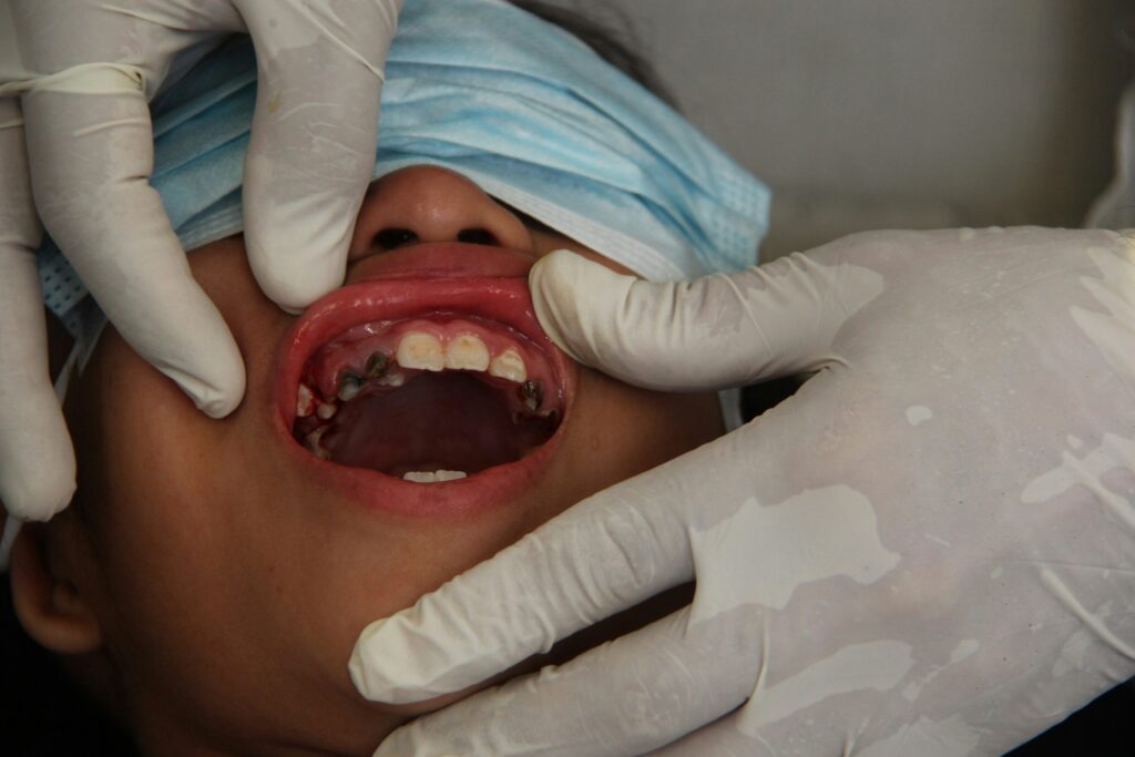 Dentist examining a child's teeth for pediatric dental problems in Lagos