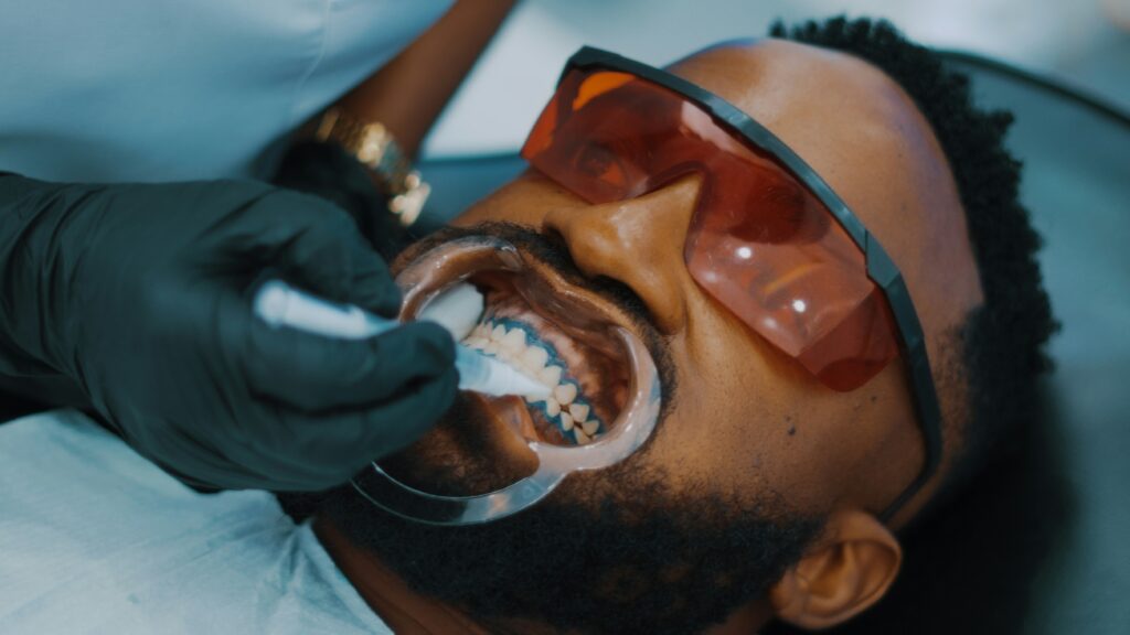 professional teeth whitening in Lagos at Lumis Dental Clinic Lekki
