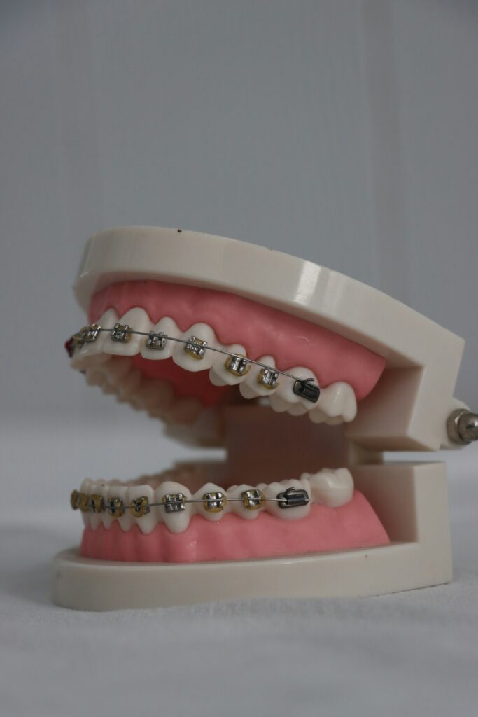 braces care in Lagos at Lumis Dental Clinic Lekki