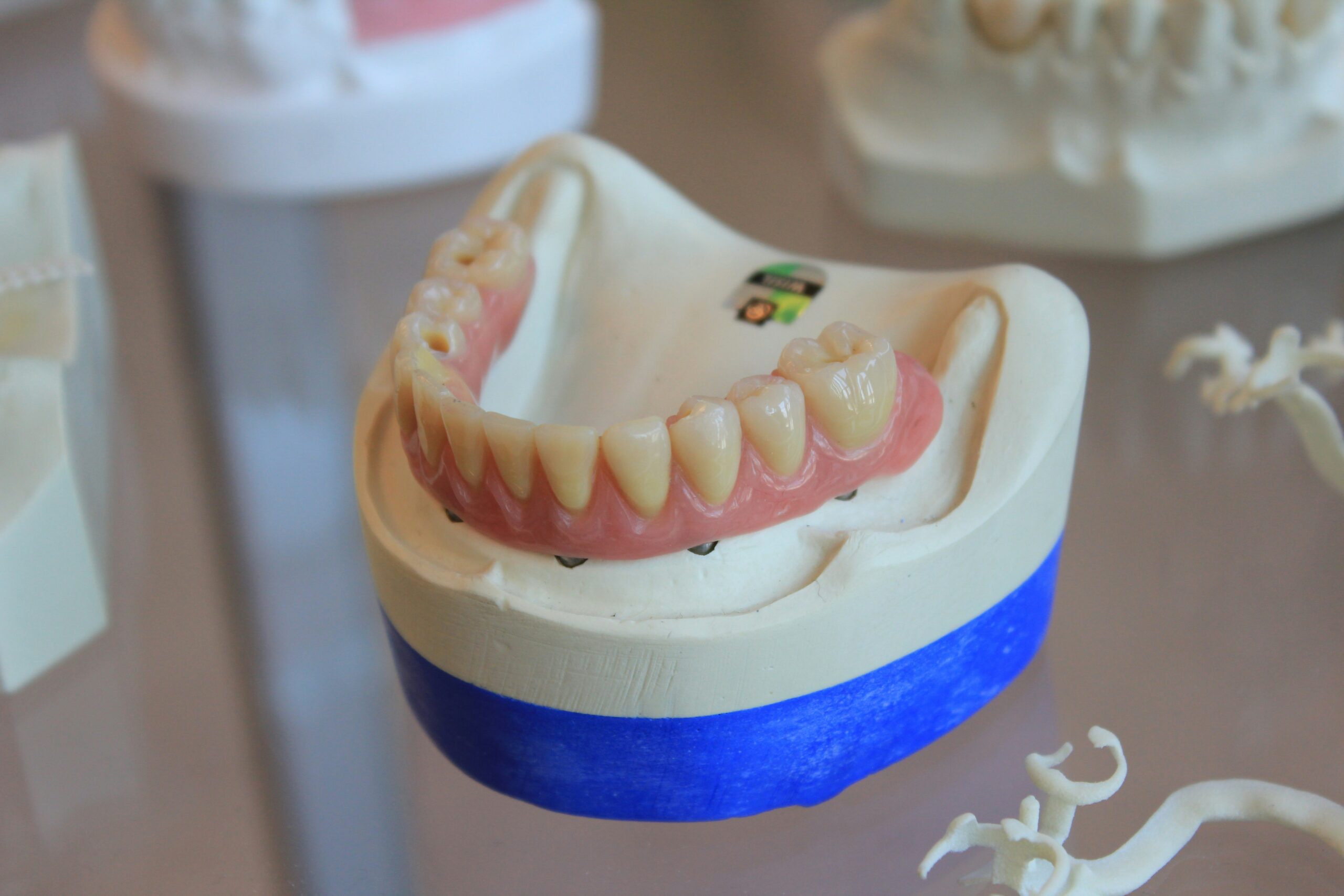 Dental implant procedure in Lagos at Lumis Dental Clinic Lekki